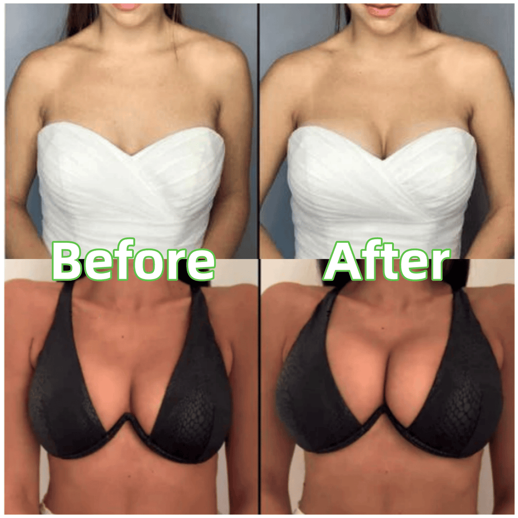 🎀🔥50% KORTING!!✨Bh-inzetstukken — Dunne vulling, dubbelzijdig plakband 👙