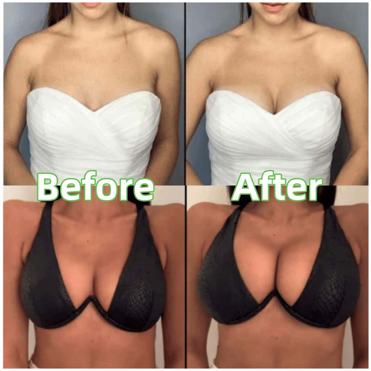 🎀🔥50% KORTING!!✨Bh-inzetstukken — Dunne vulling, dubbelzijdig plakband 👙